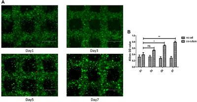 A Three-Dimensional Co-Culture Model for Rheumatoid Arthritis Pannus Tissue